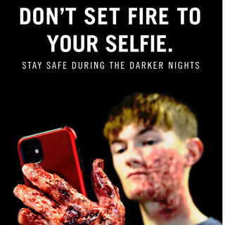 A mocked up picture of a boy badly burned on the hand by fire. Fire and ambulance staff promoting staying safe during darker nights